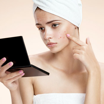 Akne Skarı & Lazer Peeling