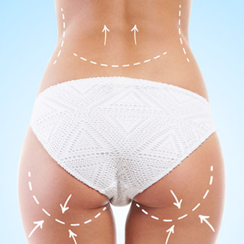 Vücut Şekillendirme & Selülit