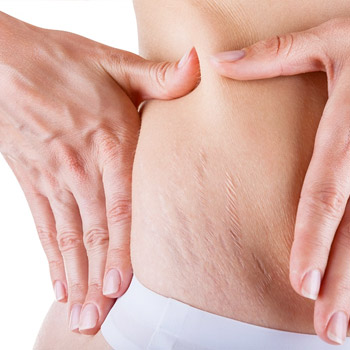 Lazer Lipoliz & Yağ Grefti